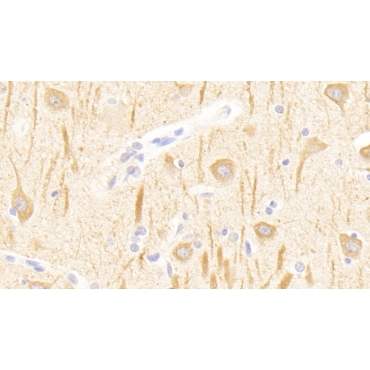 Glutamate Receptor, Metabotropic 1 (GRM1) Human Polyclonal Antibody