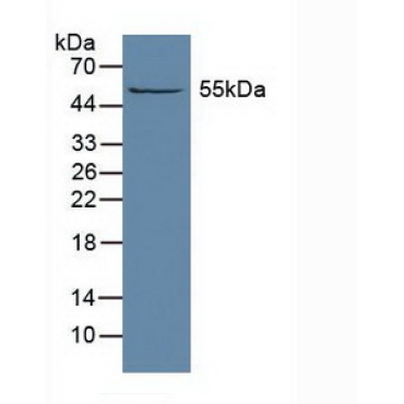 Aldehyde Dehydrogenase 1 Family, Member A1 (ALDH1A1) Human Polyclonal Antibody