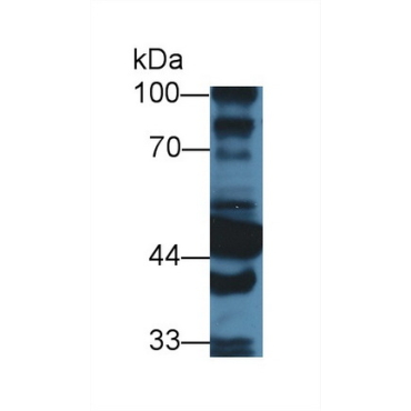 Aldehyde Dehydrogenase 1 Family, Member A1 (ALDH1A1) Mouse Polyclonal Antibody