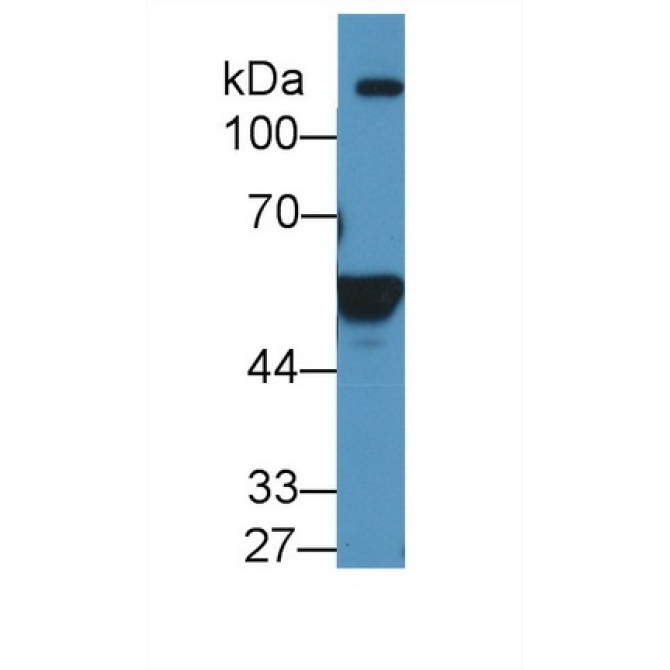 Aldehyde Dehydrogenase 1 Family, Member A2 (ALDH1A2) Human Polyclonal Antibody