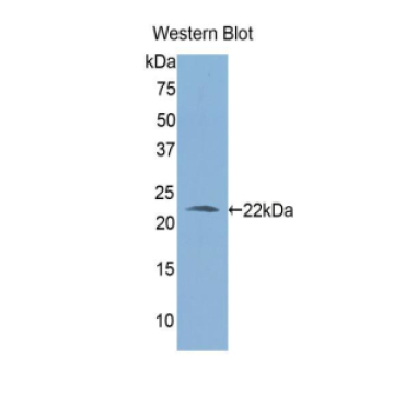 Aldehyde Dehydrogenase 1 Family, Member A3 (ALDH1A3) Human Polyclonal Antibody