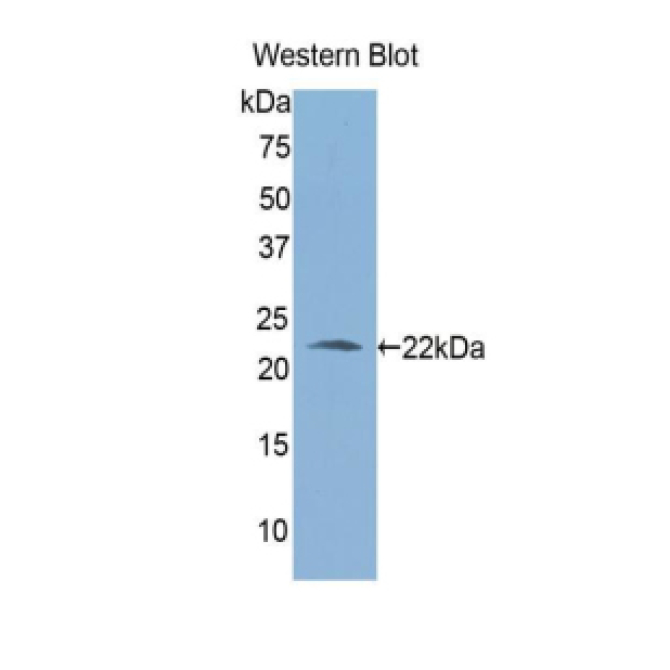 Aldehyde Dehydrogenase 1 Family, Member A3 (ALDH1A3) Human Polyclonal Antibody