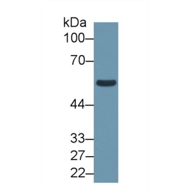 Aldehyde Dehydrogenase 1 Family, Member B1 (ALDH1B1) Human Polyclonal Antibody