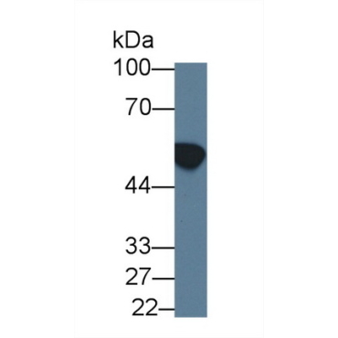 Aldehyde Dehydrogenase 3 Family, Member A1 (ALDH3A1) Human Polyclonal Antibody