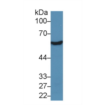 Aldehyde Dehydrogenase 7 Family, Member A1 (ALDH7A1) Human Polyclonal Antibody