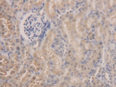 Aldehyde Dehydrogenase 7 Family, Member A1 (ALDH7A1) Rat Polyclonal Antibody