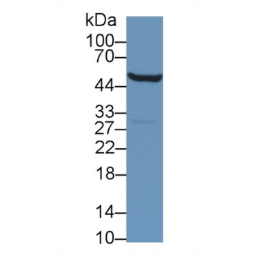 Aldehyde Dehydrogenase 9 Family, Member A1 (ALDH9A1) Mouse Polyclonal Antibody