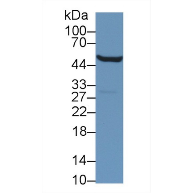 Aldehyde Dehydrogenase 9 Family, Member A1 (ALDH9A1) Mouse Polyclonal Antibody