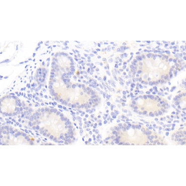Interleukin 1 Zeta (IL1z) Human Polyclonal Antibody