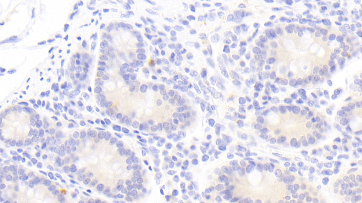 Interleukin 1 Zeta (IL1z) Human Polyclonal Antibody