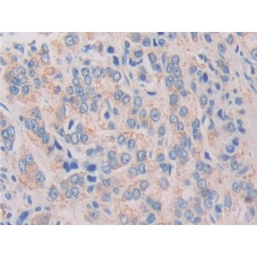 Interleukin 1 Zeta (IL1z) Human Polyclonal Antibody