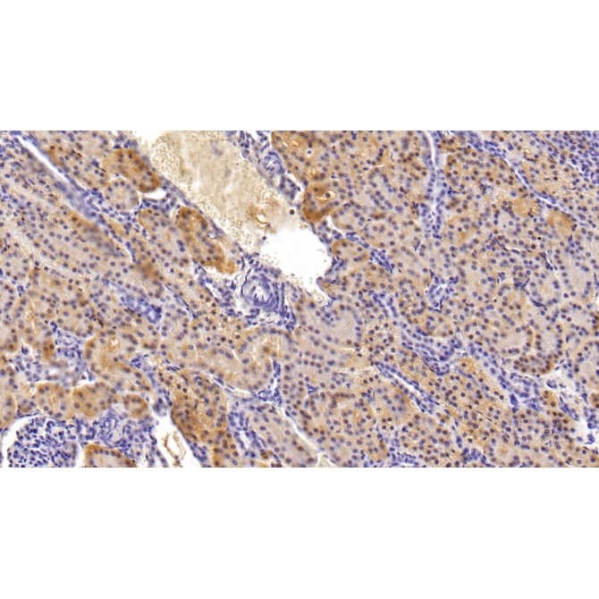 Inositol-1,4,5-Trisphosphate Receptor Type 2 (ITPR2) Human Polyclonal Antibody