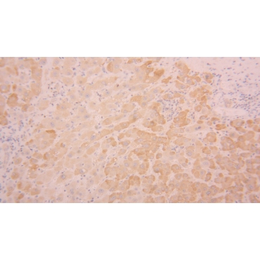 Diacylglycerol Kinase Delta (DGKd) Human Polyclonal Antibody