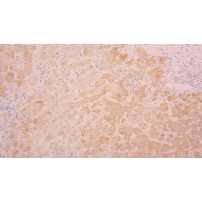 Diacylglycerol Kinase Delta (DGKd) Human Polyclonal Antibody