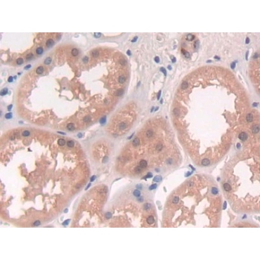 Diacylglycerol Kinase Epsilon (DGKe) Human Polyclonal Antibody