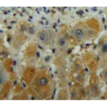 Diacylglycerol Kinase Gamma (DGKg) Human Polyclonal Antibody