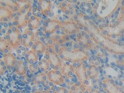 Diacylglycerol Kinase Gamma (DGKg) Rat Polyclonal Antibody