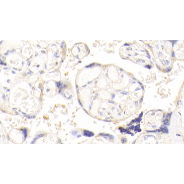 A Kinase Anchor Protein 12 (AKAP12) Human Polyclonal Antibody