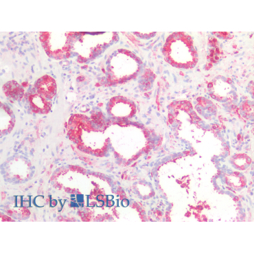 Catenin Beta Interacting Protein 1 (CTNNbIP1) Human Polyclonal Antibody