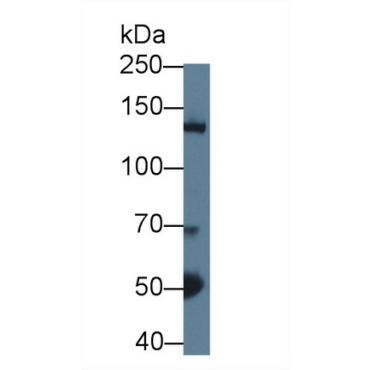 Histone Deacetylase 4 (HDAC4) Mouse Polyclonal Antibody