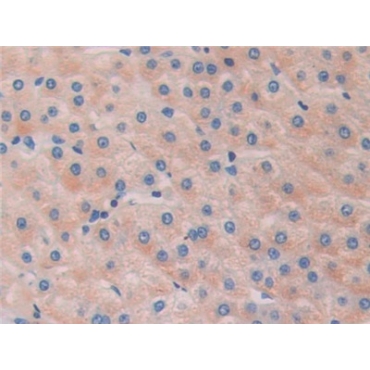 Histone Deacetylase 6 (HDAC6) Human Polyclonal Antibody
