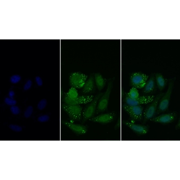 Histone Deacetylase 6 (HDAC6) Human Polyclonal Antibody