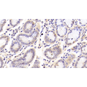Sirtuin 3 (SIRT3) Human Polyclonal Antibody