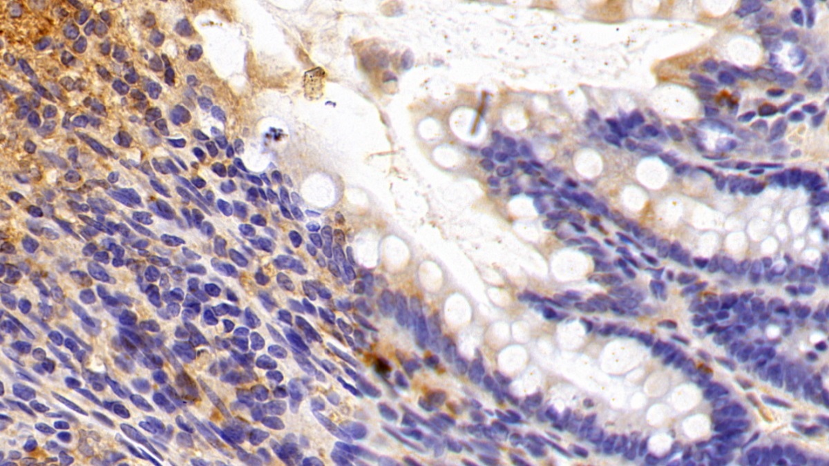 Sirtuin 3 (SIRT3) Rat Polyclonal Antibody