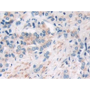 Sirtuin 4 (SIRT4) Human Polyclonal Antibody