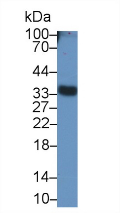 Sirtuin 5 (SIRT5) Mouse Polyclonal Antibody