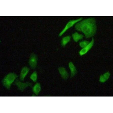 Filamin B Beta (FLNb) Human Polyclonal Antibody