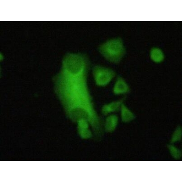 Filamin B Beta (FLNb) Human Polyclonal Antibody