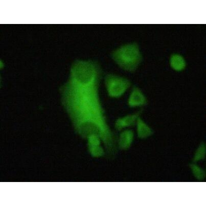 Filamin B Beta (FLNb) Human Polyclonal Antibody