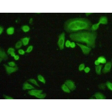 Filamin B Beta (FLNb) Human Polyclonal Antibody