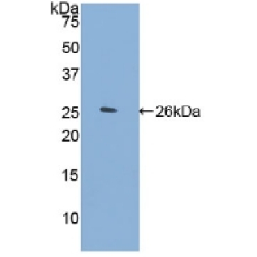 Filamin C Gamma (FLNC) Human Polyclonal Antibody