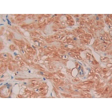 Filamin C Gamma (FLNC) Human Polyclonal Antibody