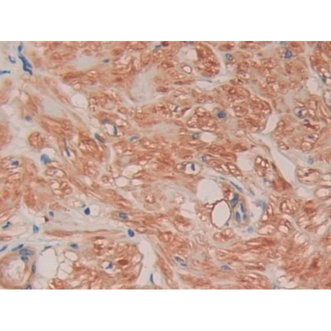 Filamin C Gamma (FLNC) Human Polyclonal Antibody
