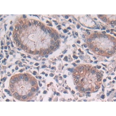 Ring Finger Protein 55 (RNF55) Human Polyclonal Antibody