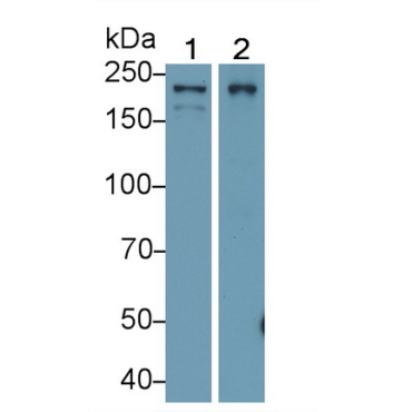 Eukaryotic Translation Initiation Factor 2 Alpha Kinase 4 (EIF2aK4) Human Polyclonal Antibody