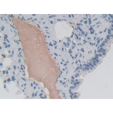 Eukaryotic Translation Initiation Factor 2 Alpha Kinase 3 (EIF2aK3) Mouse Polyclonal Antibody