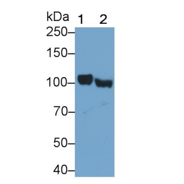 A Kinase Anchor Protein 3 (AKAP3) Human Polyclonal Antibody