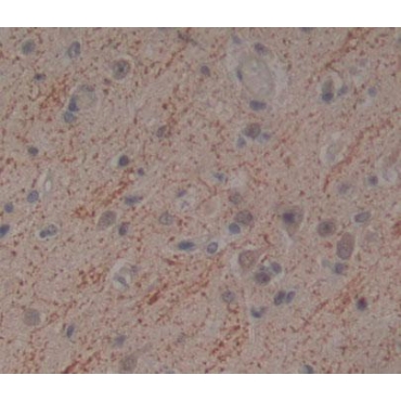 Eukaryotic Translation Initiation Factor 2C1 (EIF2C1) Human Polyclonal Antibody