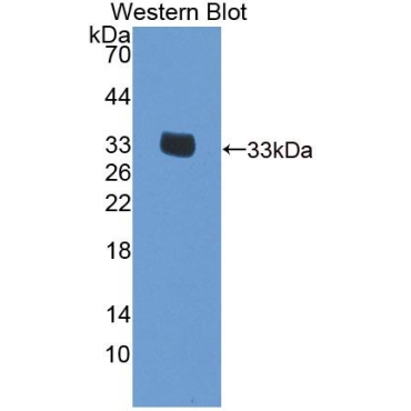 Eukaryotic Translation Initiation Factor 2 Subunit 1 (EIF2S1) Human Polyclonal Antibody
