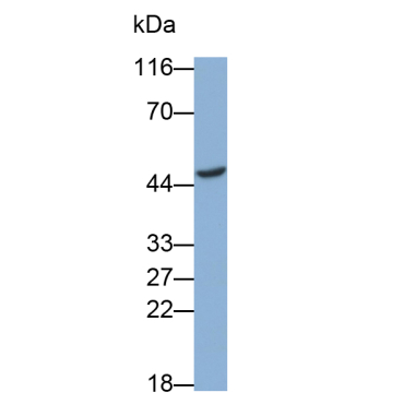 Eukaryotic Translation Initiation Factor 4A1 (EIF4A1) Human Polyclonal Antibody