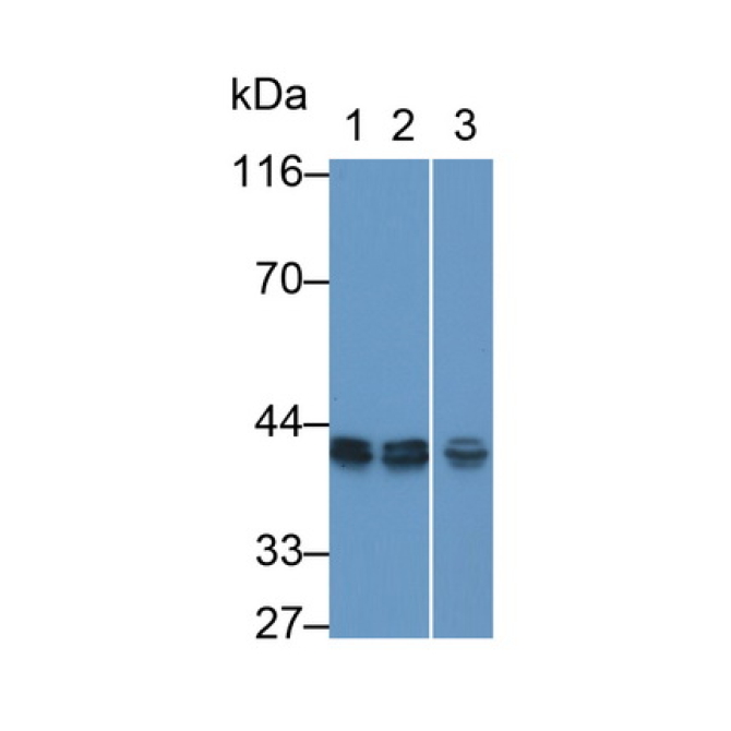 Eukaryotic Translation Elongation Factor 1 Delta (EEF1d) Human Polyclonal Antibody