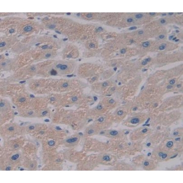 Eukaryotic Elongation Factor 2 Kinase (EEF2K) Human Polyclonal Antibody