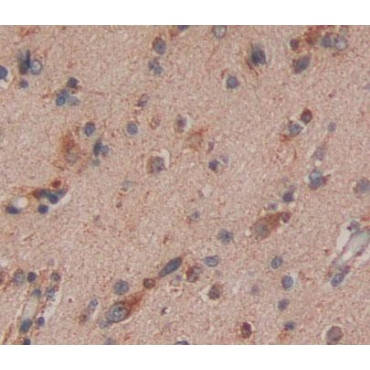 Eukaryotic Translation Termination Factor 1 (ETF1) Human Polyclonal Antibody