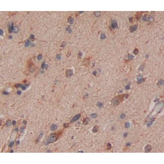 Eukaryotic Translation Termination Factor 1 (ETF1) Human Polyclonal Antibody