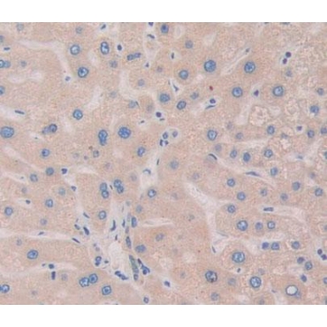 Tripartite Motif Containing Protein 5 (TRIM5) Human Polyclonal Antibody
