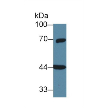 G Protein Alpha 11 (GNa11) Human Polyclonal Antibody